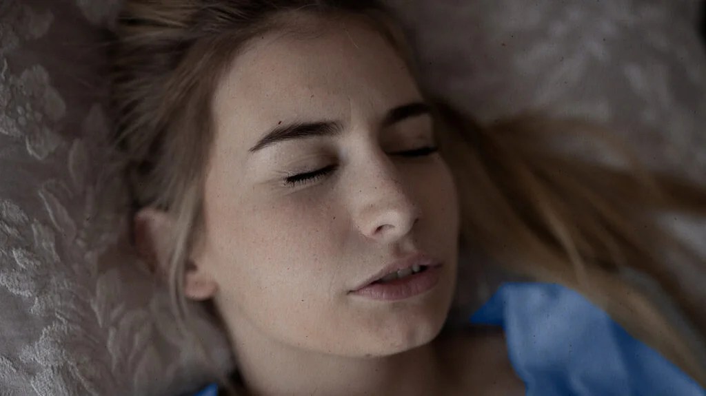 تآكل المينا